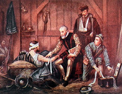 Amputación de un miembro